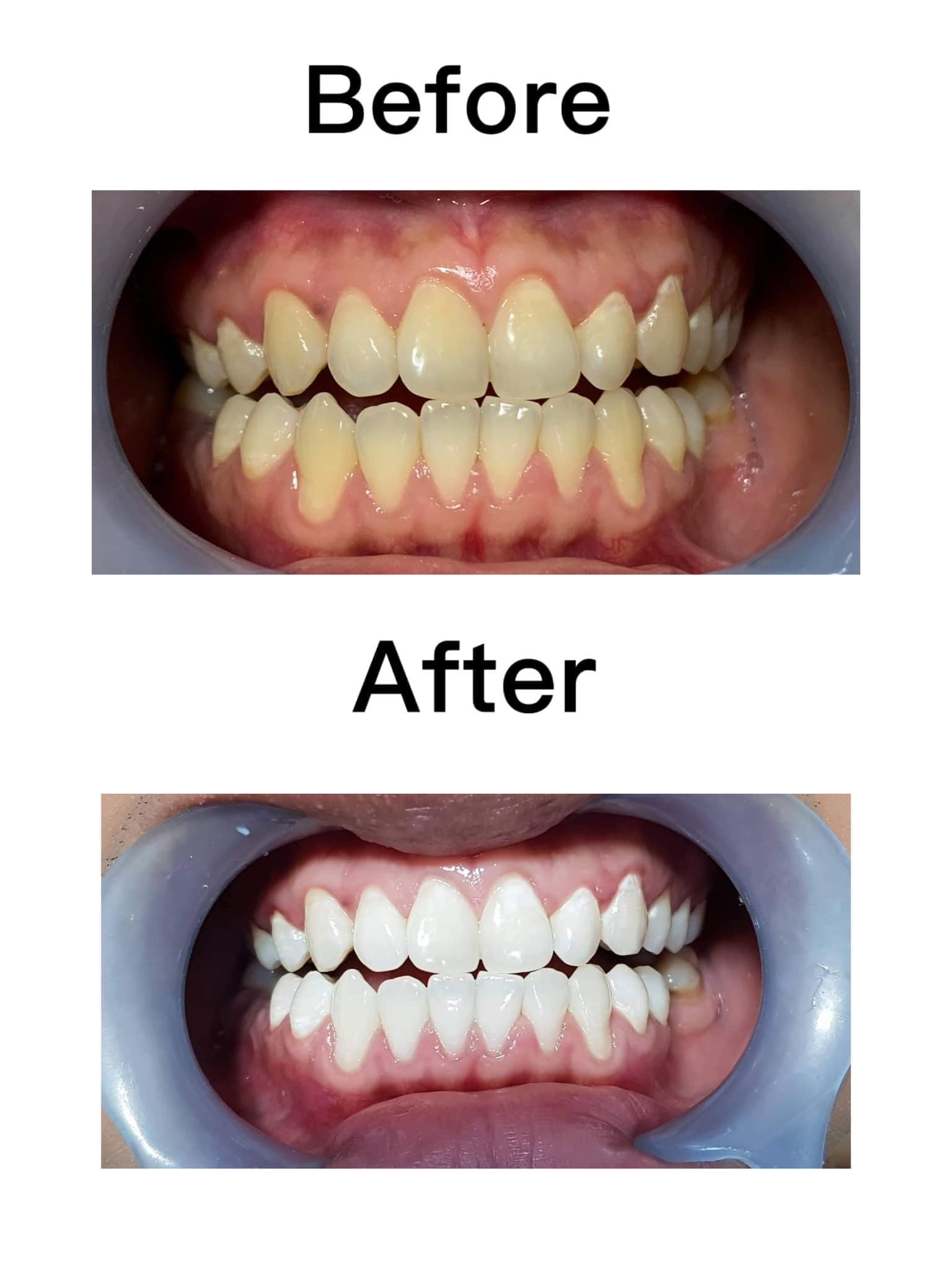 Teeth
