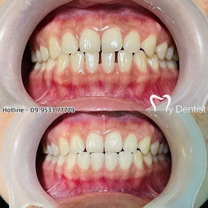 Teeth