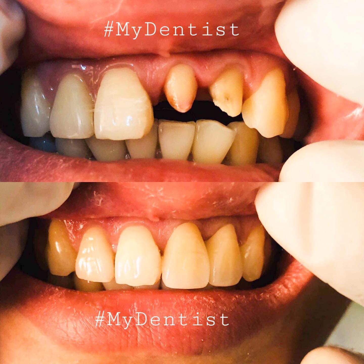 Teeth