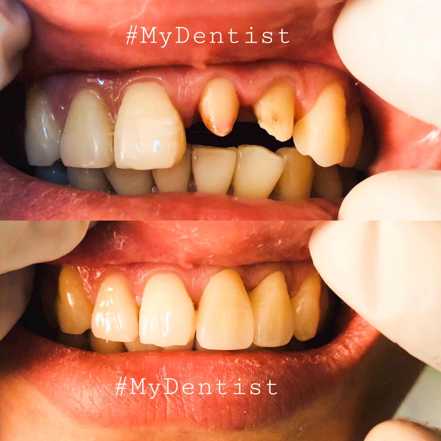 Teeth