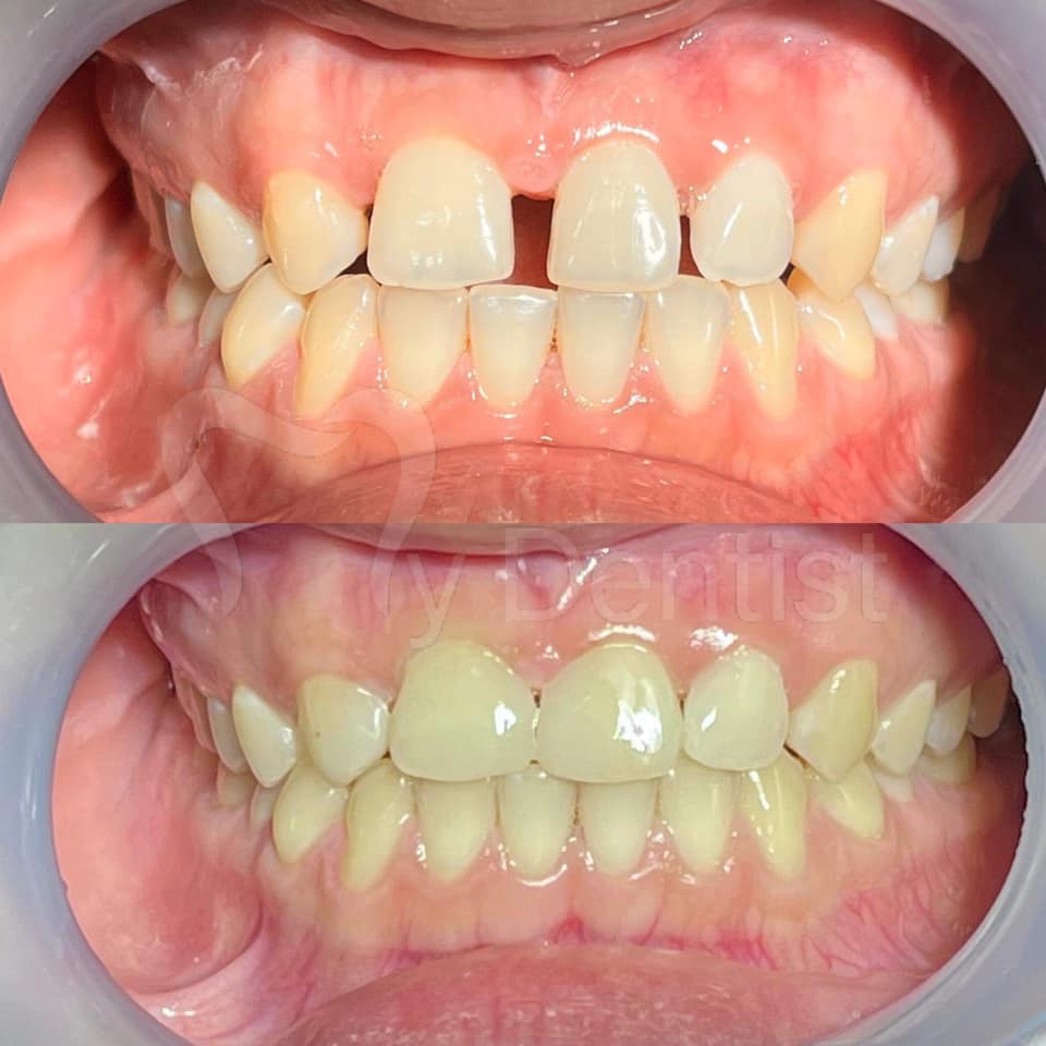 Teeth