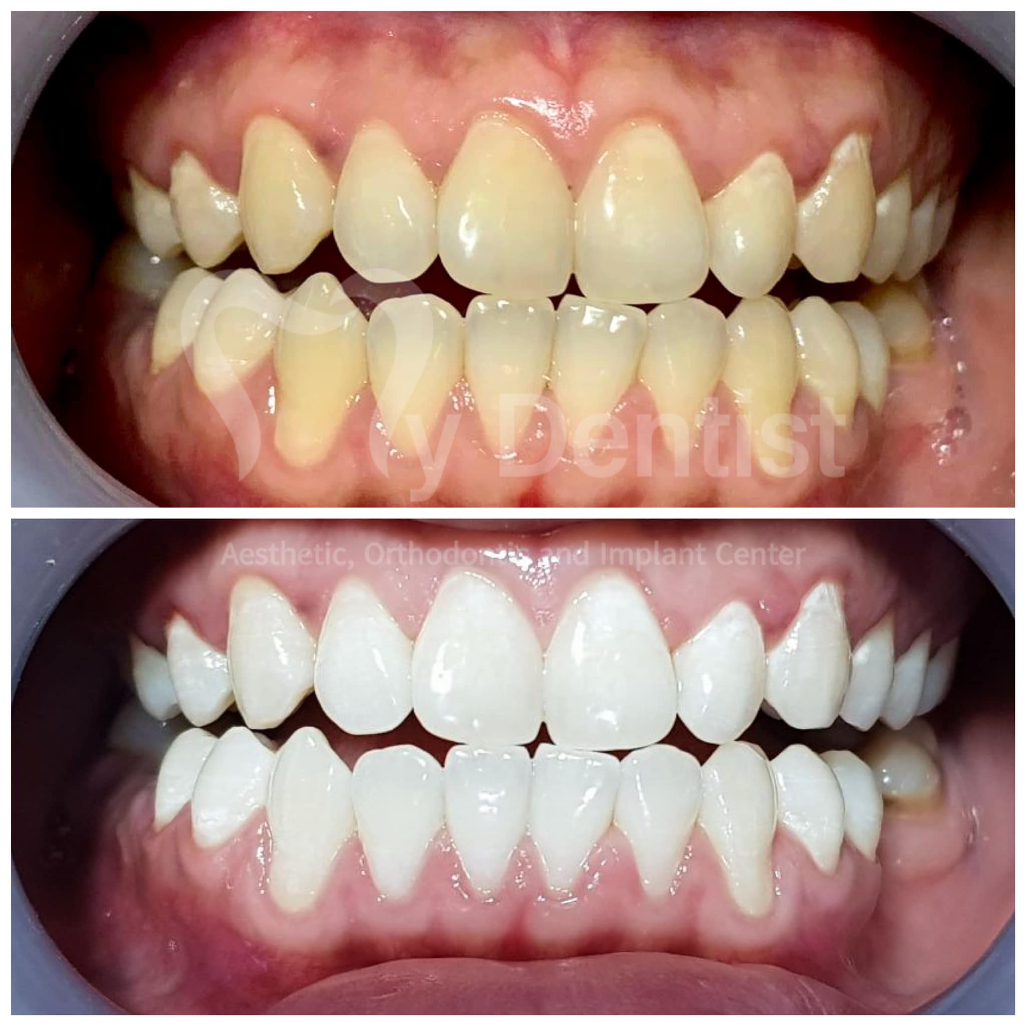 Teeth